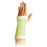 Central Infusion Alliance Arm Cast - RC435SA