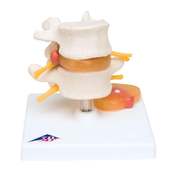 Wolters Kluwer Health Inc Lumbar Vertebral Column Model Anatomical Each - A76/5