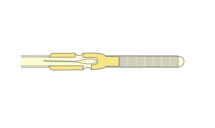 Avanos Medical Sales LLC CORFLO-ULTRA NG Nasogastric Feeding Tube 10 Fr. 36 Inch - 40-7361