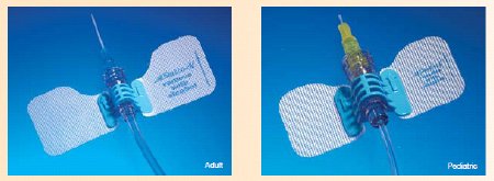 Statlock - Extension Set with Stabilization Device StatLock 6 Inch Tubing 2 Ports DEHP-Free - IV0564