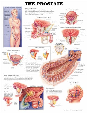 Anatomical Chart Company Anatomical Chart Prostate 20 X 26 Inch Plastic Wall Mount Laminated - 9781587791895