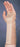 Bird & Cronin Independence Wrist Brace Palmar Stay Right Hand Small - 8145742