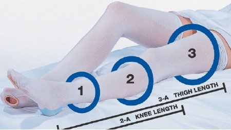 CAP - Anti-embolism Stocking Cap Thigh High X-Large / Short White Inspection Toe - 640