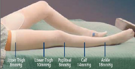 T.E.D. - Anti-embolism Stocking Thigh High 2X-Large / Long White Inspection Toe - 3185LF