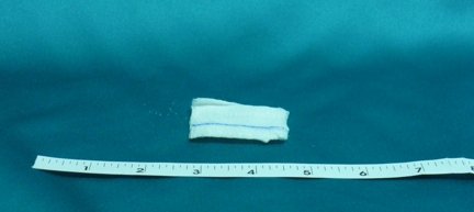 Bioseal Bioseal X-Ray Detectable Gauze Sponge Cotton 12-Ply 2 X 2 Inch Square Sterile - 7320/50