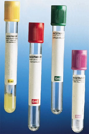 Becton Dickinson BD Vacutainer SST Venous Blood Collection Tube Serum Tube Clot Activator / Separator Gel Additive 16 X 100 mm 8.5 mL Red / Gray Mottled Conventional Closure Plastic Tube - 367988