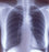 McKesson Clear Choice Performance X-Ray Film 7 X 17 Inch Half Speed Green Sensitive High - EK795