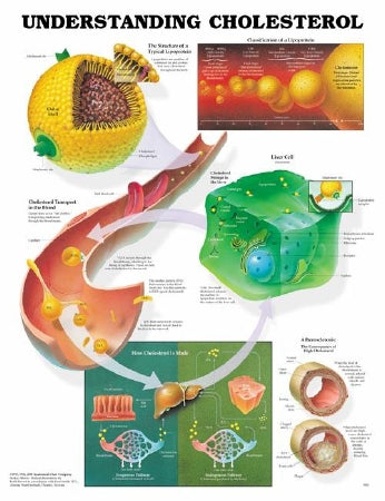 Anatomical Chart Company - Anatomical Chart Understanding Cholesterol 20 X 26 Inch Plastic Wall Mount Laminated - 9781587793264