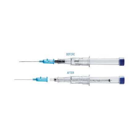 VanishPoint - Peripheral IV Catheter 24 Gauge 0.75 Inch Retracting Safety Needle - 31221