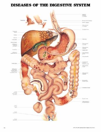 Anatomical Chart Company Anatomical Chart Diseases of the Digestive System 20 X 26 Inch Plastic Wall Mount Laminated - 9781587792366