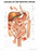 Anatomical Chart Company Anatomical Chart Diseases of the Digestive System 20 X 26 Inch Plastic Wall Mount Laminated - 9781587792366