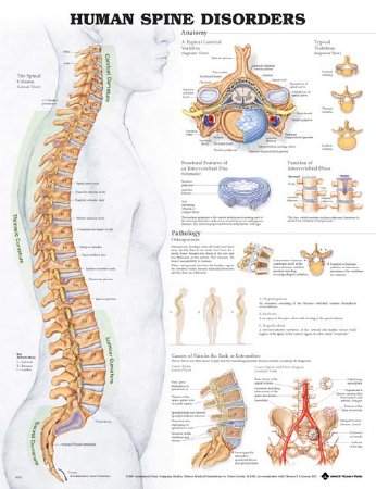 Anatomical Chart Company Anatomical Chart Human Spine Disorders 20 X 26 Inch Plastic Wall Mount Laminated - 9781587794438