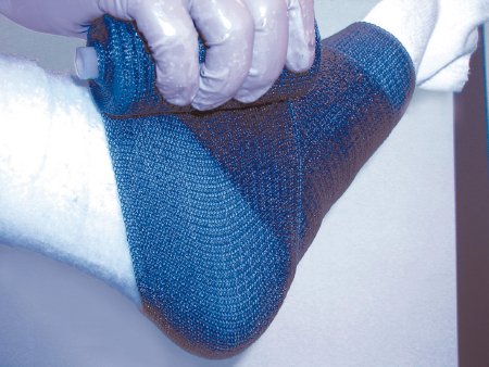BSN Medical Delta-Lite Plus Cast Tape 5 Inch X 12 Foot Fiberglass White - 7345804