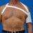 Rolyan - Hemi Arm Sling Elastc Straps X-Large, Left, 28 - 34 Inch Acromion / Chest - A6539