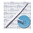 Acu-Dispo-Curette - Dermal Curette 5 Inch Length Flat Handle 1 mm Tip Loop Tip - R0150