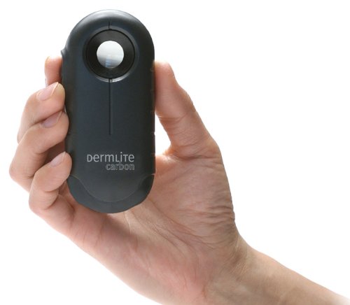 Dermatoscope