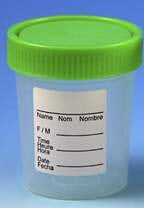 Fisher Scientific Specimen Container 53 mm Opening Polypropylene Screw Cap 90 mL (3 oz.) Sterile - 22150106
