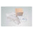 Vyaire Medical Inc Kit Suction Catheter Cath-N-Glove Disposable 100/Ca - 4898T