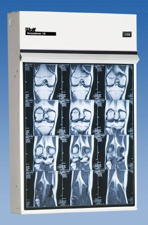 Trimline III - X-Ray Illuminator 3 Bank 1 Tier 3 Lamp 15 W Mobile Stand 42 W X 22 H X 3-1/4 D Inch Three, 17 L X 14 W Inch Film - 23403