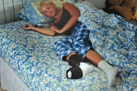 Airform - Night Splint Large Hook and Loop Closure Male 9-1/2 to 14 / Female 10-1/2 to 15 Left or Right Foot - 56085602
