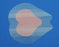 Ferris Manufacturing PolyMem Shapes Foam Dressing with Silver Polymem Shapes 7.2 X 7.8 Inch Sacral Sterile - 1709