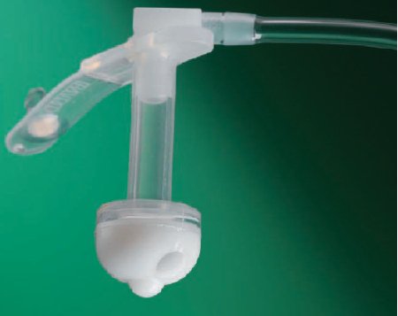 Bard Bard Button Gastrostomy Feeding Tube 28 Fr. 10 Inch NonSterile - 269