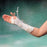 Patterson Medical Supply Dynamic Finger Splint Aluminum - A60132