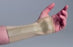 Darco International Wrist Support Palmar Stay Elastic Large - 252-1030-50