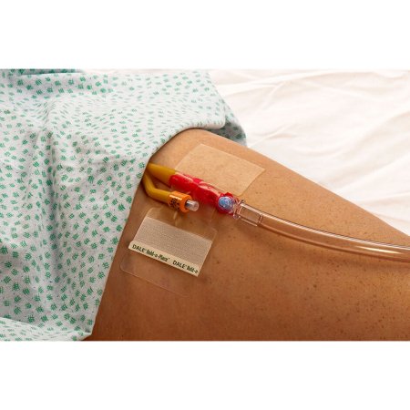 Hold-n-Place - Catheter Holder One Size Fits All, Adhesive Patch - 150