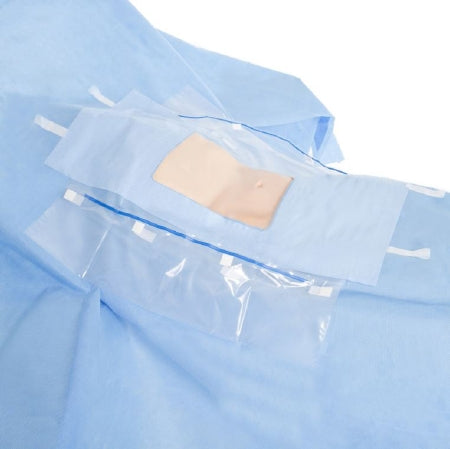 O&M Halyard Inc Abdominal Drape Laparoscopic / Cholecystectomy Drape 104 W X 76 W X 102 L Inch Sterile - 89538