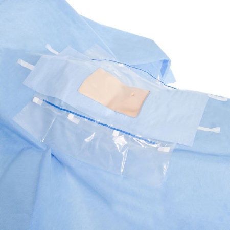 O&M Halyard - Abdominal Drape Laparoscopic / Cholecystectomy Drape 104 W X 76 W X 102 L Inch Sterile - 89538