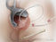 Biodesign - Anal Fistula Plug Set - G53614