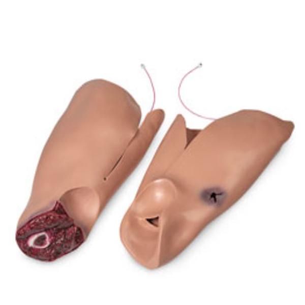 Nasco Company Leg Moulage Trauma Flash Adult 2/Pk - 808-6002