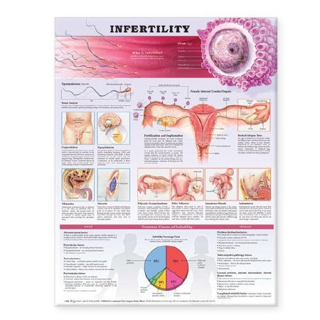 Anatomical Chart Company Anatomical Chart Infertility 19 X 26 Inch Plastic Wall Mount Laminated - 158779859X