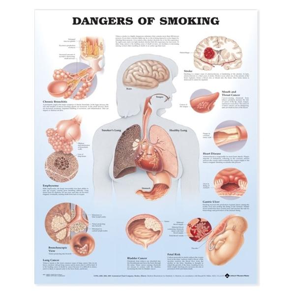 Wolters Kluwer Health Inc Chart Educational Dangers Of Smoking 20X26" Ea - 9781587792311