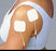 PALS - Pals Neurostimulation Electrode - 3931