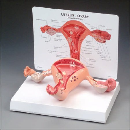 Anatomical Chart Company Uterus/Ovary Model Full Size - G348