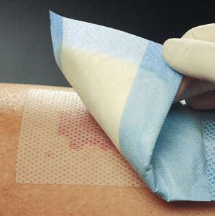 Molnlycke Mepitel Wound Dressing Silicone 3 X 2 Inch Sterile - 290599