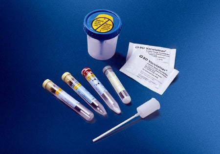 Becton Dickinson BD Vacutainer Urinalysis Tube Conical Bottom Chlorhexadine / Ethyl Paraben / Sodium Propionate Additive 16 X 100 mm 8 mL Red / Yellow Mottled Conventional Closure Plastic Tube - 364992
