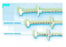 Conmed Entake PEG Safety Push Kit EnTake 18 Fr. Sterile - FESG1800