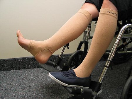 GeriLeg - Leg Sleeve 2X-Large - 20-500