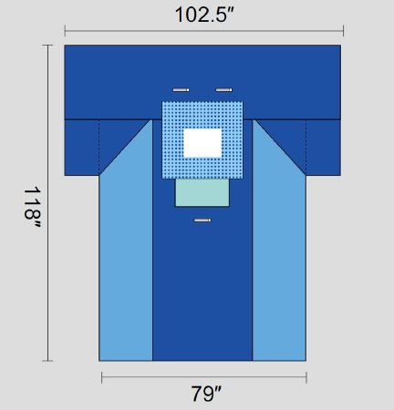 Welmed Surgical Drape Chest Drape 102-1/2 W X 79 W X 118 L Inch Sterile - 1222-2156