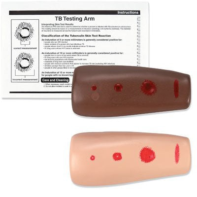 Nasco TB Testing Arm - SB25973