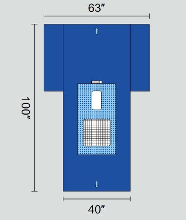 Welmed EENT Drape Cysto T-Drape with Screen 63 W X 40 W X 100 L Inch Sterile - 1222-5000
