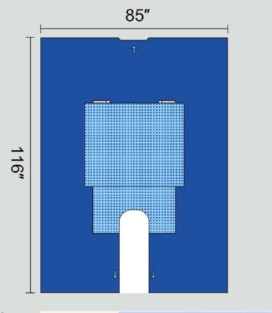 Welmed Orthopedic Drape Body Split Shoulder Drape 85 W X 116 L Inch Sterile - 1222-8665