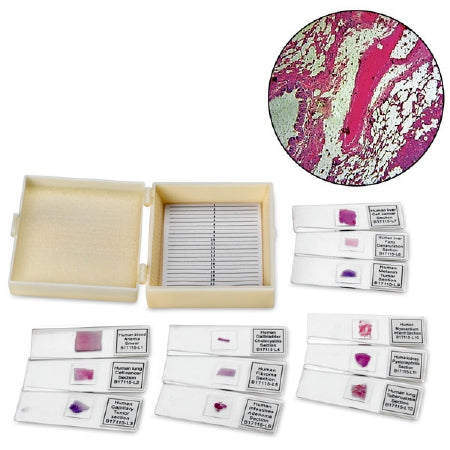 Nasco Human Pathology Prepared Microscope Slide Set 1 X 3 Inch Prepared Slide - SB47764