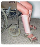 Alimed DermaSaver Protective Leg Tube Medium - 66417/NA/NA/MD