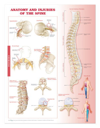 Anatomical Chart Company Anatomical Chart Anatomy and Injuries of the Spine 20 X 26 Inch Heavy Paper Grommets Laminated - 9780781786676
