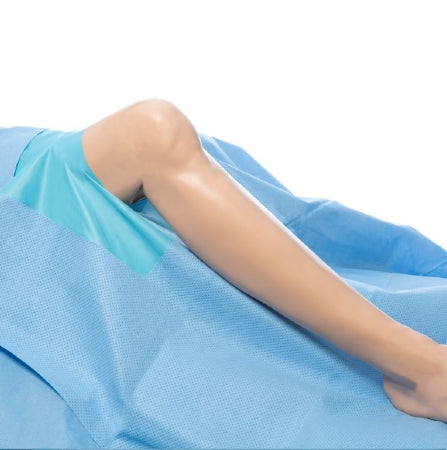 O&M Halyard Inc Orthoarts Orthopedic Drape Lower Extremity Drape 114 W X 80 W X 144 L Inch Sterile - 29222