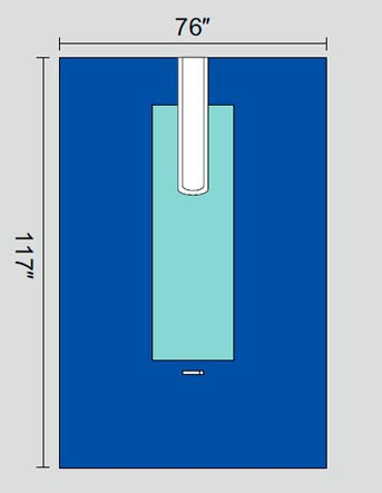 Welmed Surgical Drape Split Drape 76 W X 117 L Inch Sterile - 1222-1942